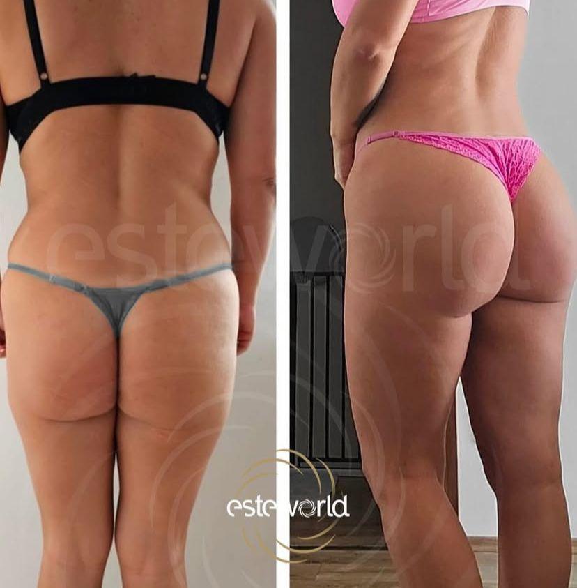 Body Contouring · Plastic Surgery
