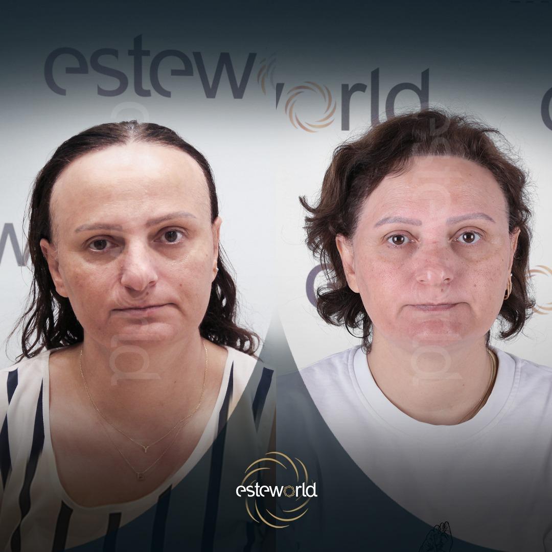Facial Rejuvenation · Non-invasive Treatments