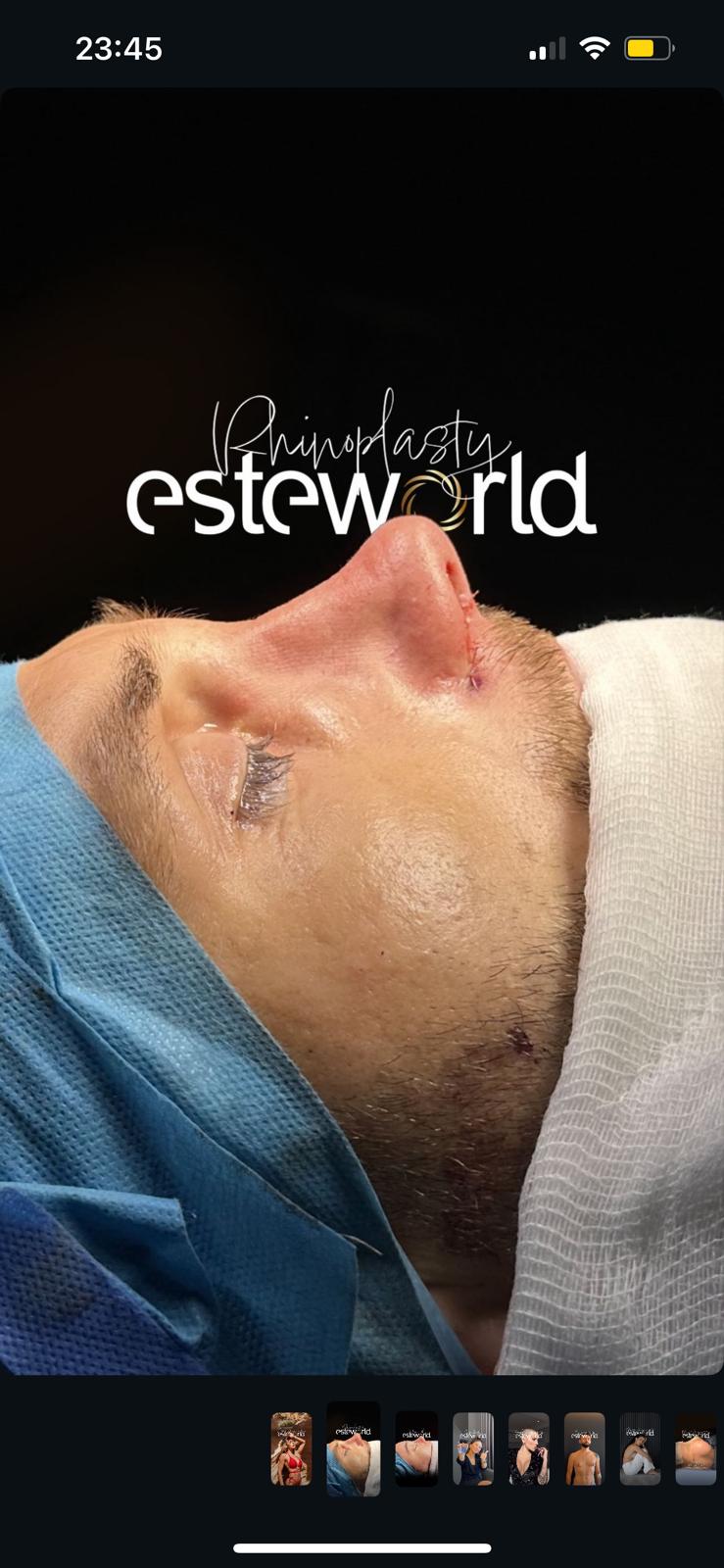 Facial Aesthetic Surgery · Plastic Surgery