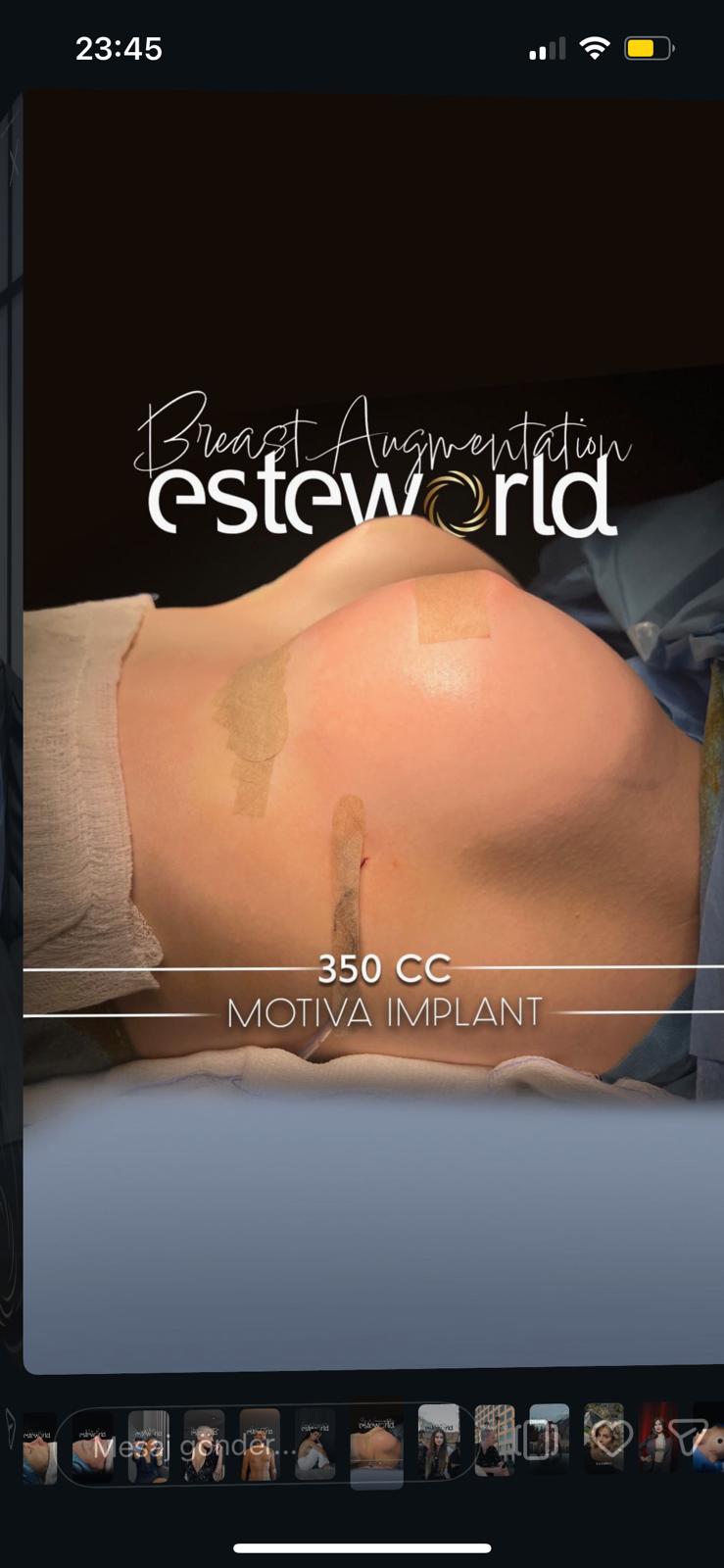 Body Contouring · Plastic Surgery