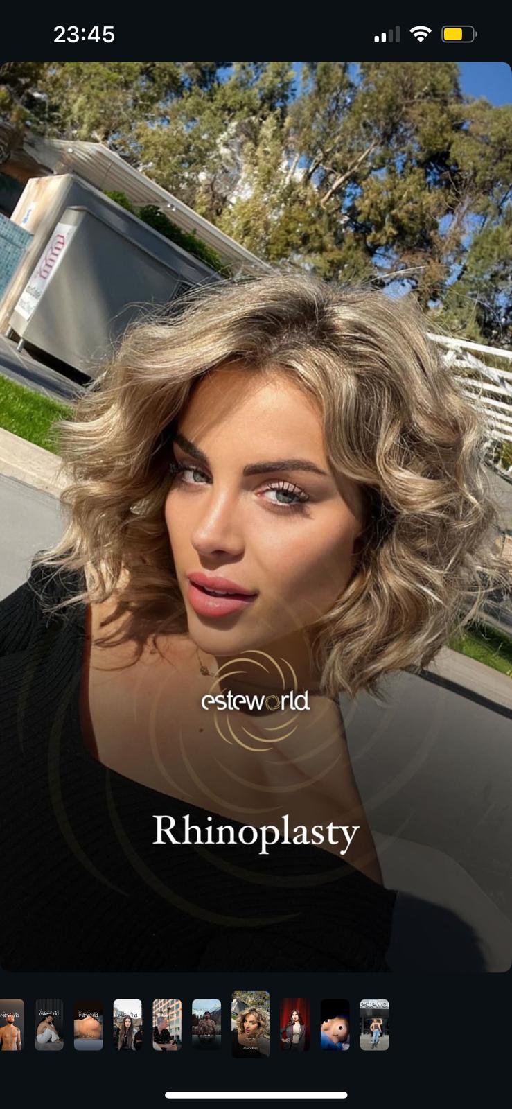 Rhinoplasty · Plastic Surgery