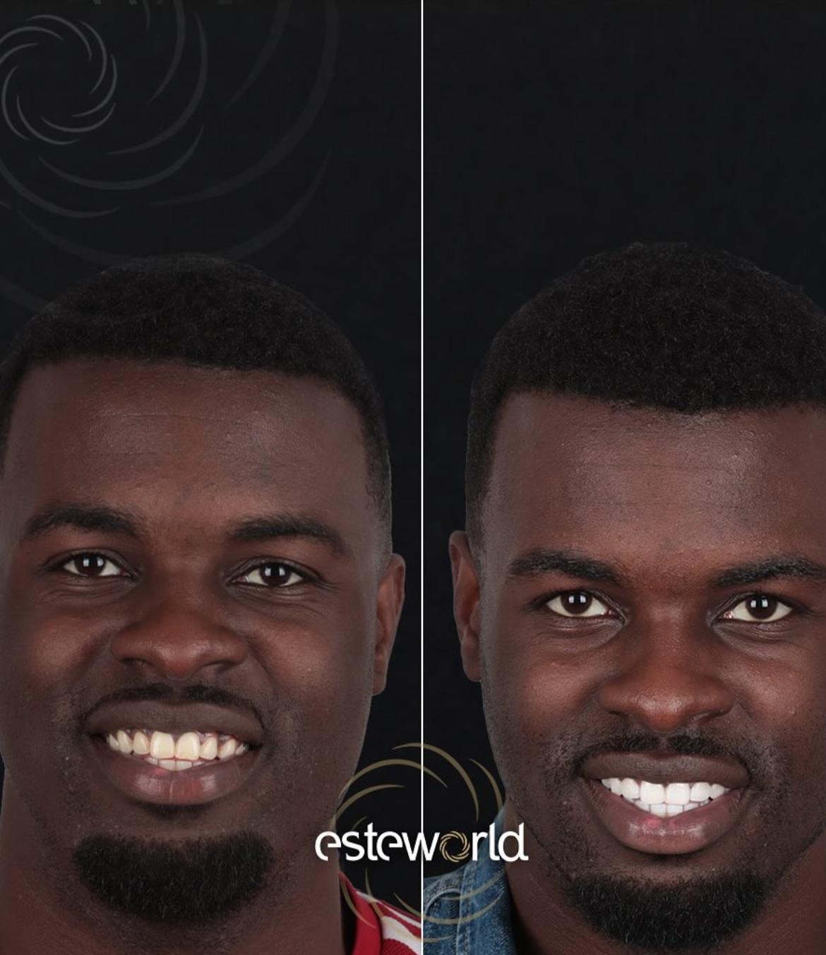 Hollywood Smile · Dental Treatments